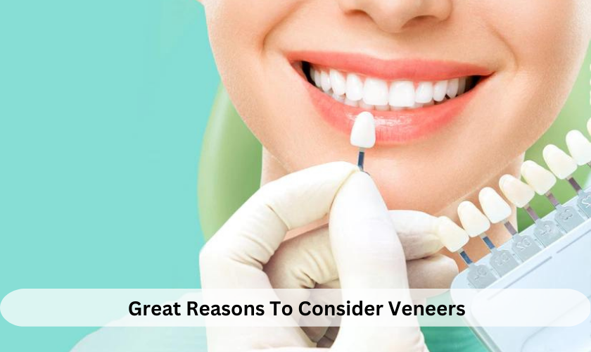 Great Reasons To Consider Veneers