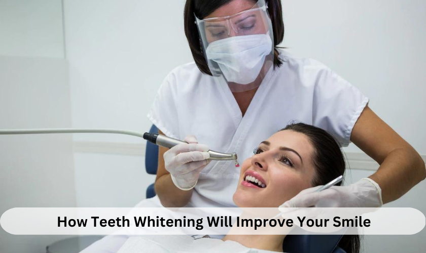 How Teeth Whitening Will Improve Your Smile