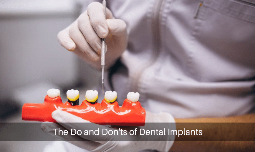The Do and Don'ts of Dental Implants