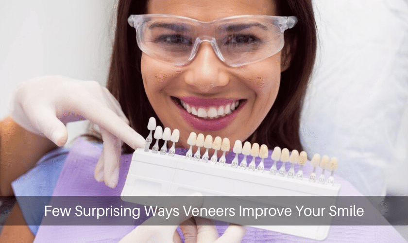 Few Surprising Ways Veneers Improve Your Smile