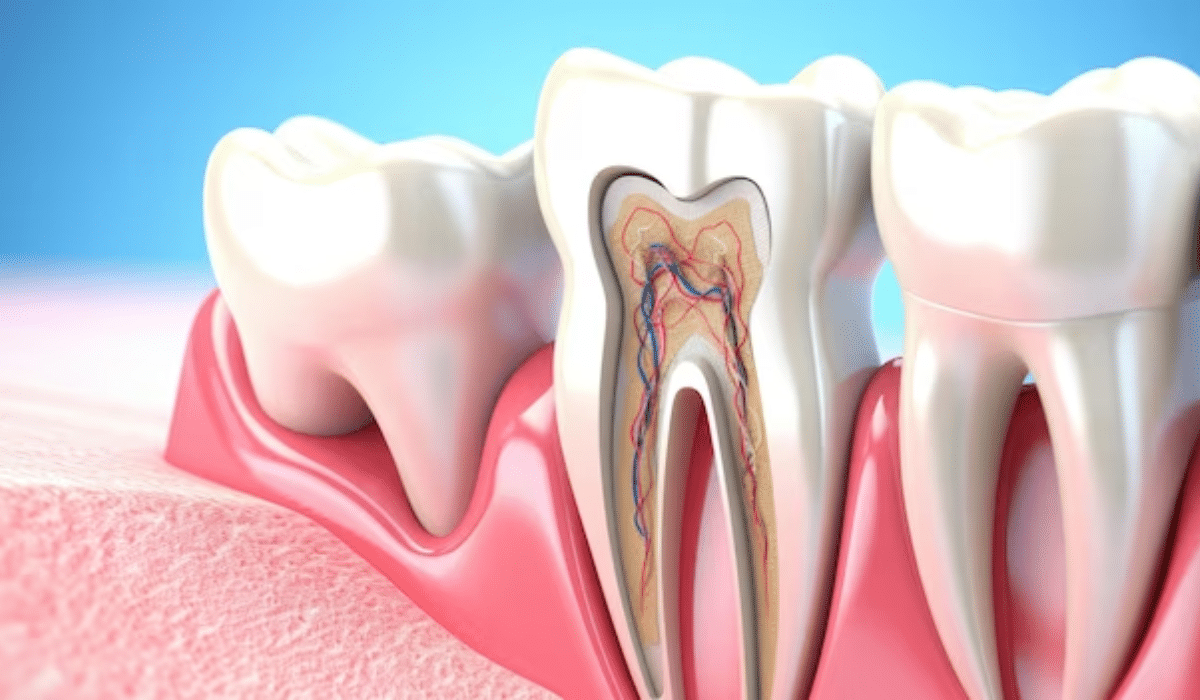 Common Signs Of Root Canal Infection
